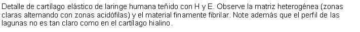 Cuadro de texto: Detalle de cartlago elstico de laringe humana teido con H y E. Observe la matriz heterognea (zonas claras alternando con zonas acidfilas) y el material finamente fibrilar. Note adems que el perfil de las lagunas no es tan claro como en el cartlago hialino.