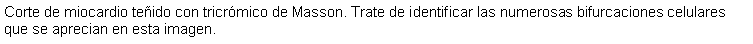 Cuadro de texto: Corte de miocardio teido con tricrmico de Masson. Trate de identificar las numerosas bifurcaciones celulares que se aprecian en esta imagen. 