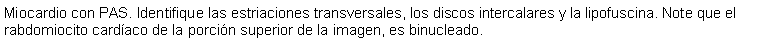 Cuadro de texto: Miocardio con PAS. Identifique las estriaciones transversales, los discos intercalares y la lipofuscina. Note que el rabdomiocito cardaco de la porcin superior de la imagen, es binucleado. 