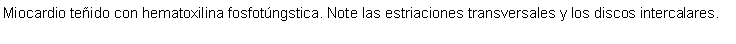 Cuadro de texto: Miocardio teido con hematoxilina fosfotngstica. Note las estriaciones transversales y los discos intercalares. 