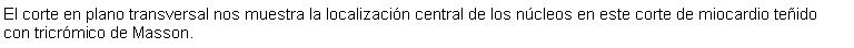 Cuadro de texto: El corte en plano transversal nos muestra la localizacin central de los ncleos en este corte de miocardio teido con tricrmico de Masson. 