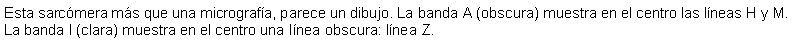 Cuadro de texto: Esta sarcmera ms que una micrografa, parece un dibujo. La banda A (obscura) muestra en el centro las lneas H y M. La banda I (clara) muestra en el centro una lnea obscura: lnea Z. 