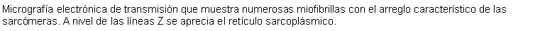 Cuadro de texto: Micrografa electrnica de transmisin que muestra numerosas miofibrillas con el arreglo caracterstico de las sarcmeras. A nivel de las lneas Z se aprecia el retculo sarcoplsmico.