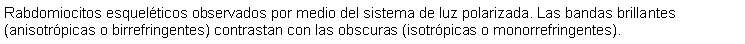 Cuadro de texto: Rabdomiocitos esquelticos observados por medio del sistema de luz polarizada. Las bandas brillantes (anisotrpicas o birrefringentes) contrastan con las obscuras (isotrpicas o monorrefringentes).