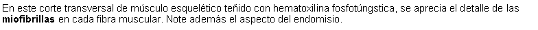 Cuadro de texto: En este corte transversal de msculo esqueltico teido con hematoxilina fosfotngstica, se aprecia el detalle de las miofibrillas en cada fibra muscular. Note adems el aspecto del endomisio.