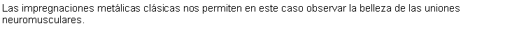 Cuadro de texto: Las impregnaciones metlicas clsicas nos permiten en este caso observar la belleza de las uniones neuromusculares. 