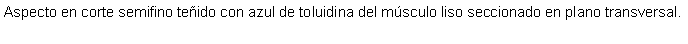 Cuadro de texto: Aspecto en corte semifino teido con azul de toluidina del msculo liso seccionado en plano transversal.
