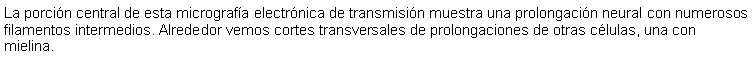 Cuadro de texto: La porcin central de esta micrografa electrnica de transmisin muestra una prolongacin neural con numerosos filamentos intermedios. Alrededor vemos cortes transversales de prolongaciones de otras clulas, una con mielina. 