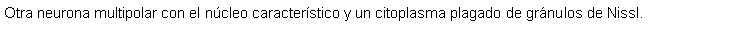 Cuadro de texto: Otra neurona multipolar con el ncleo caracterstico y un citoplasma plagado de grnulos de Nissl. 