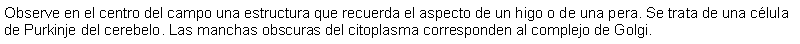 Cuadro de texto: Observe en el centro del campo una estructura que recuerda el aspecto de un higo o de una pera. Se trata de una clula de Purkinje del cerebelo. Las manchas obscuras del citoplasma corresponden al complejo de Golgi. 