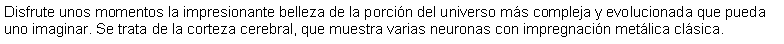 Cuadro de texto: Disfrute unos momentos la impresionante belleza de la porcin del universo ms compleja y evolucionada que pueda uno imaginar. Se trata de la corteza cerebral, que muestra varias neuronas con impregnacin metlica clsica.