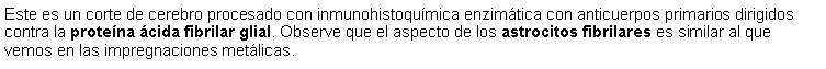 Cuadro de texto: Este es un corte de cerebro procesado con inmunohistoqumica enzimtica con anticuerpos primarios dirigidos contra la protena cida fibrilar glial. Observe que el aspecto de los astrocitos fibrilares es similar al que vemos en las impregnaciones metlicas. 