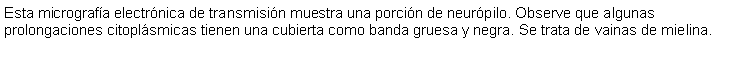 Cuadro de texto: Esta micrografa electrnica de transmisin muestra una porcin de neurpilo. Observe que algunas prolongaciones citoplsmicas tienen una cubierta como banda gruesa y negra. Se trata de vainas de mielina.  