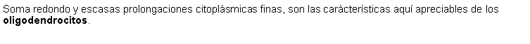 Cuadro de texto: Soma redondo y escasas prolongaciones citoplsmicas finas, son las carctersticas aqu apreciables de los oligodendrocitos.