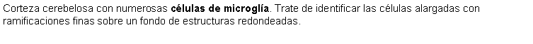 Cuadro de texto: Corteza cerebelosa con numerosas clulas de microgla. Trate de identificar las clulas alargadas con ramificaciones finas sobre un fondo de estructuras redondeadas.