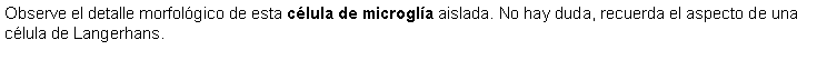 Cuadro de texto: Observe el detalle morfolgico de esta clula de microgla aislada. No hay duda, recuerda el aspecto de una clula de Langerhans.