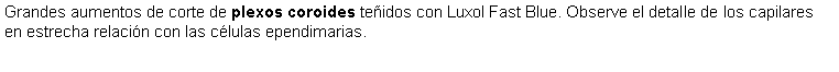 Cuadro de texto: Grandes aumentos de corte de plexos coroides teidos con Luxol Fast Blue. Observe el detalle de los capilares en estrecha relacin con las clulas ependimarias. 