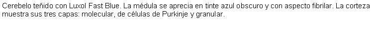 Cuadro de texto: Cerebelo teido con Luxol Fast Blue. La mdula se aprecia en tinte azul obscuro y con aspecto fibrilar. La corteza muestra sus tres capas: molecular, de clulas de Purkinje y granular.