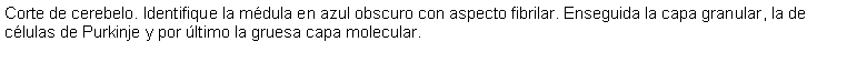 Cuadro de texto: Corte de cerebelo. Identifique la mdula en azul obscuro con aspecto fibrilar. Enseguida la capa granular, la de clulas de Purkinje y por ltimo la gruesa capa molecular.