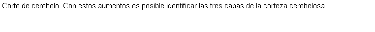 Cuadro de texto: Corte de cerebelo. Con estos aumentos es posible identificar las tres capas de la corteza cerebelosa.