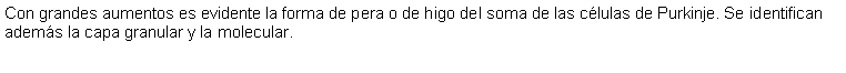 Cuadro de texto: Con grandes aumentos es evidente la forma de pera o de higo del soma de las clulas de Purkinje. Se identifican adems la capa granular y la molecular. 