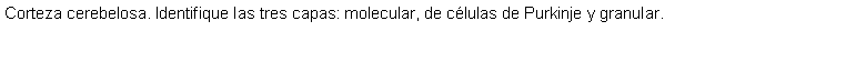 Cuadro de texto: Corteza cerebelosa. Identifique las tres capas: molecular, de clulas de Purkinje y granular. 