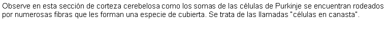 Cuadro de texto: Observe en esta seccin de corteza cerebelosa como los somas de las clulas de Purkinje se encuentran rodeados por numerosas fibras que les forman una especie de cubierta. Se trata de las llamadas clulas en canasta.