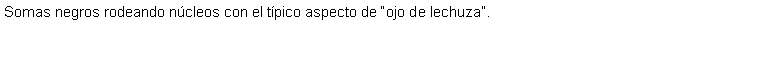 Cuadro de texto: Somas negros rodeando ncleos con el tpico aspecto de ojo de lechuza.