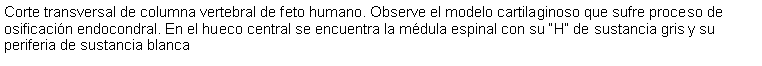 Cuadro de texto: Corte transversal de columna vertebral de feto humano. Observe el modelo cartilaginoso que sufre proceso de osificacin endocondral. En el hueco central se encuentra la mdula espinal con su H de sustancia gris y su periferia de sustancia blanca