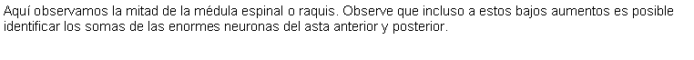 Cuadro de texto: Aqu observamos la mitad de la mdula espinal o raquis. Observe que incluso a estos bajos aumentos es posible identificar los somas de las enormes neuronas del asta anterior y posterior.