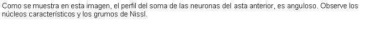 Cuadro de texto: Como se muestra en esta imagen, el perfil del soma de las neuronas del asta anterior, es anguloso. Observe los ncleos caractersticos y los grumos de Nissl.