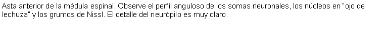 Cuadro de texto: Asta anterior de la mdula espinal. Observe el perfil anguloso de los somas neuronales, los ncleos en ojo de lechuza y los grumos de Nissl. El detalle del neurpilo es muy claro. 