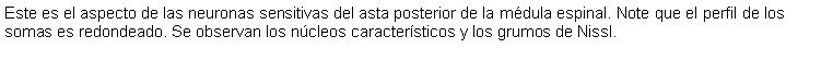 Cuadro de texto: Este es el aspecto de las neuronas sensitivas del asta posterior de la mdula espinal. Note que el perfil de los somas es redondeado. Se observan los ncleos caractersticos y los grumos de Nissl. 