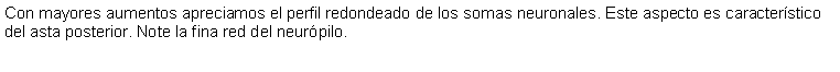 Cuadro de texto: Con mayores aumentos apreciamos el perfil redondeado de los somas neuronales. Este aspecto es caracterstico del asta posterior. Note la fina red del neurpilo. 