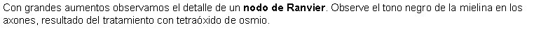 Cuadro de texto: Con grandes aumentos observamos el detalle de un nodo de Ranvier. Observe el tono negro de la mielina en los axones, resultado del tratamiento con tetraxido de osmio.