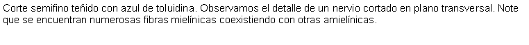 Cuadro de texto: Corte semifino teido con azul de toluidina. Observamos el detalle de un nervio cortado en plano transversal. Note que se encuentran numerosas fibras mielnicas coexistiendo con otras amielnicas.