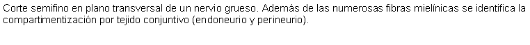 Cuadro de texto: Corte semifino en plano transversal de un nervio grueso. Adems de las numerosas fibras mielnicas se identifica la compartimentizacin por tejido conjuntivo (endoneurio y perineurio).