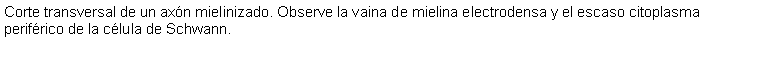Cuadro de texto: Corte transversal de un axón mielinizado. Observe la vaina de mielina electrodensa y el escaso citoplasma periférico de la célula de Schwann.
