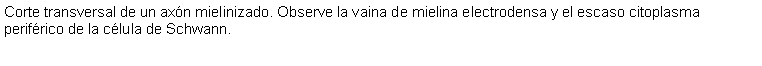 Cuadro de texto: Corte transversal de un axn mielinizado. Observe la vaina de mielina electrodensa y el escaso citoplasma perifrico de la clula de Schwann.