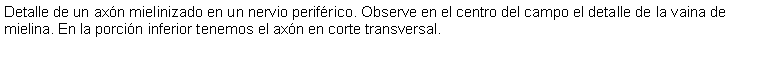 Cuadro de texto: Detalle de un axn mielinizado en un nervio perifrico. Observe en el centro del campo el detalle de la vaina de mielina. En la porcin inferior tenemos el axn en corte transversal.