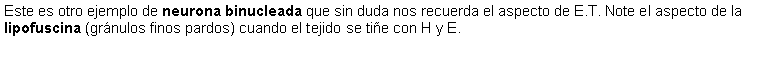 Cuadro de texto: Este es otro ejemplo de neurona binucleada que sin duda nos recuerda el aspecto de E.T. Note el aspecto de la lipofuscina (grnulos finos pardos) cuando el tejido se tie con H y E. 