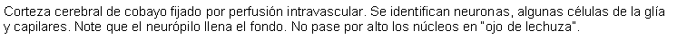 Cuadro de texto: Corteza cerebral de cobayo fijado por perfusin intravascular. Se identifican neuronas, algunas clulas de la gla y capilares. Note que el neurpilo llena el fondo. No pase por alto los ncleos en ojo de lechuza.