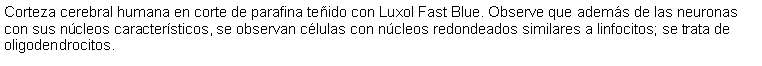 Cuadro de texto: Corteza cerebral humana en corte de parafina teido con Luxol Fast Blue. Observe que adems de las neuronas con sus ncleos caractersticos, se observan clulas con ncleos redondeados similares a linfocitos; se trata de oligodendrocitos. 