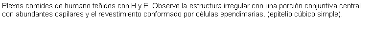 Cuadro de texto: Plexos coroides de humano teidos con H y E. Observe la estructura irregular con una porcin conjuntiva central con abundantes capilares y el revestimiento conformado por clulas ependimarias. (epitelio cbico simple).