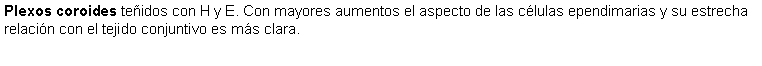 Cuadro de texto: Plexos coroides teidos con H y E. Con mayores aumentos el aspecto de las clulas ependimarias y su estrecha relacin con el tejido conjuntivo es ms clara.