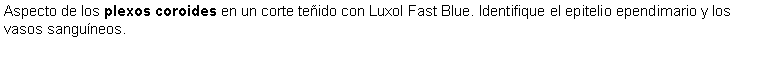 Cuadro de texto: Aspecto de los plexos coroides en un corte teido con Luxol Fast Blue. Identifique el epitelio ependimario y los vasos sanguneos.