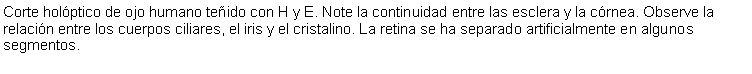 Cuadro de texto: Corte holptico de ojo humano teido con H y E. Note la continuidad entre las esclera y la crnea. Observe la relacin entre los cuerpos ciliares, el iris y el cristalino. La retina se ha separado artificialmente en algunos segmentos. 