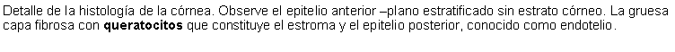 Cuadro de texto: Detalle de la histologa de la crnea. Observe el epitelio anterior plano estratificado sin estrato crneo. La gruesa capa fibrosa con queratocitos que constituye el estroma y el epitelio posterior, conocido como endotelio. 