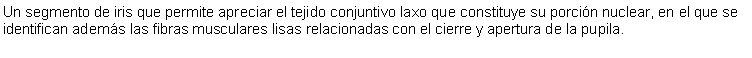 Cuadro de texto: Un segmento de iris que permite apreciar el tejido conjuntivo laxo que constituye su porcin nuclear, en el que se identifican adems las fibras musculares lisas relacionadas con el cierre y apertura de la pupila.