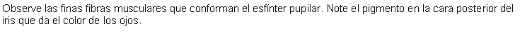 Cuadro de texto: Observe las finas fibras musculares que conforman el esfnter pupilar. Note el pigmento en la cara posterior del iris que da el color de los ojos.